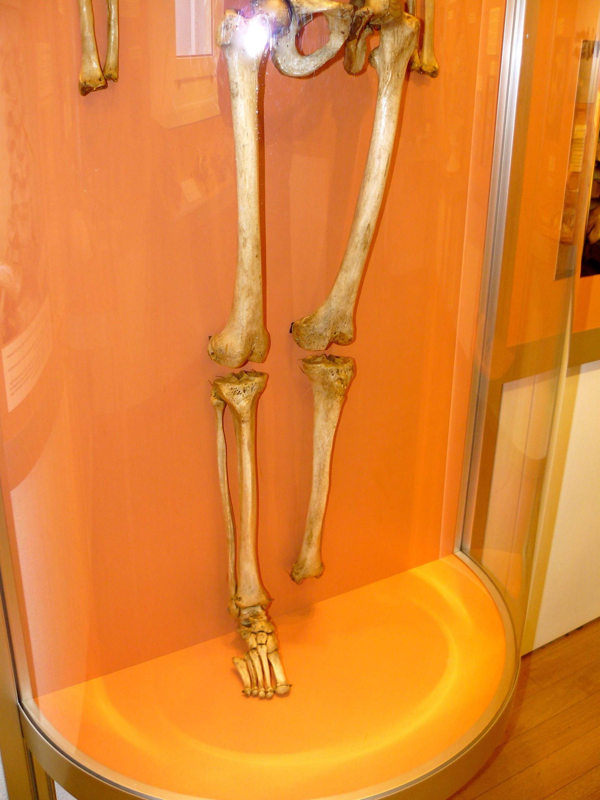 Andreas Vesalius skeleton 3.jpg